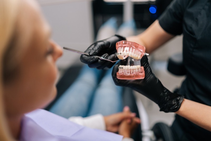 De ce să alegi OrtoCare pentru tratamentul cu aparat dentar: avantajele pe care le oferim