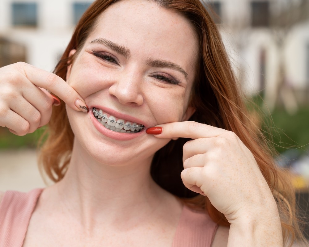 aparat dentar bucuresti