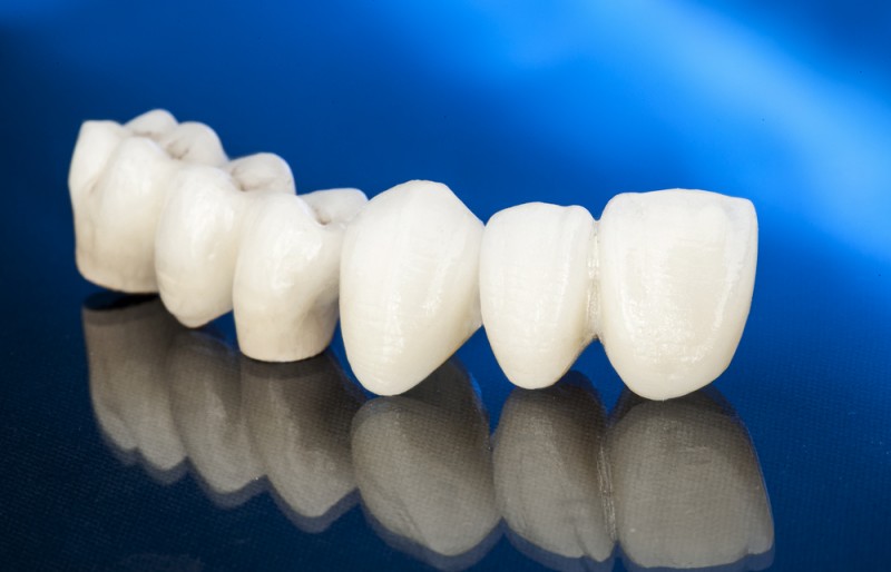 Sistemele dentare cu zirconiu permit tratamente restaurative protetice avansate