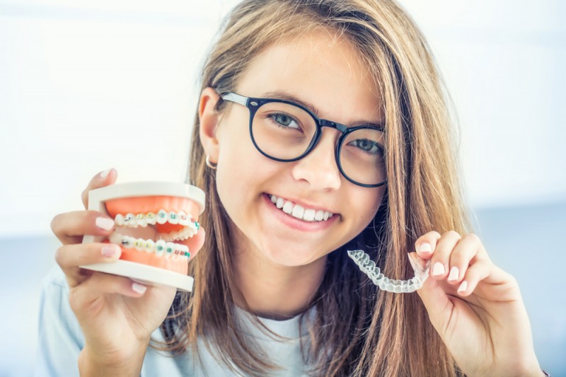 Ce tipuri de aparat dentar oferă Orto Care? Avantaje și dezavantaje