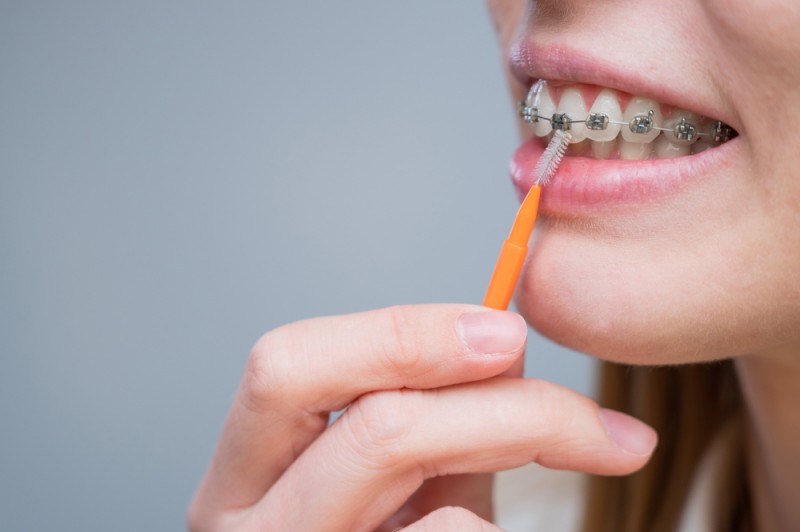 Ce indicații și contraindicații ne impune purtarea aparatului dentar