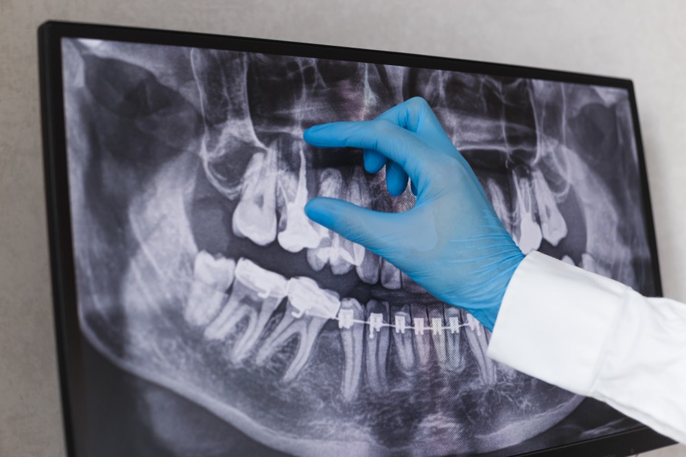 aparat dentar bucuresti, clinica stomatologica orto care bucuresti