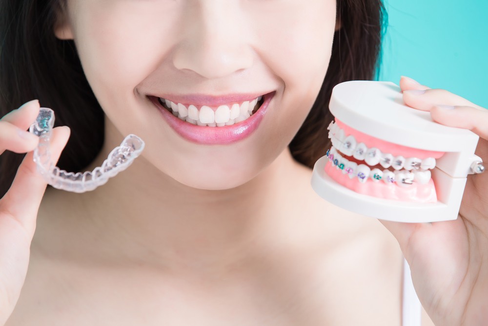 aparat dentar Bucuresti