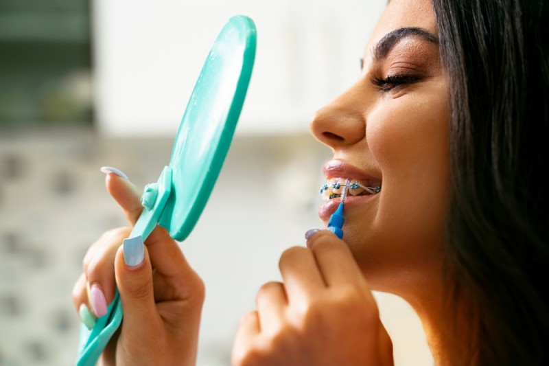 Cum se schimbă rutina de igienă orală după montarea unui aparat dentar la OrtoCare?