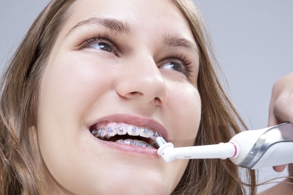 aparat dentar bucuresti, aparat dentar copii, clinica stomatologica orto care bucuresti
