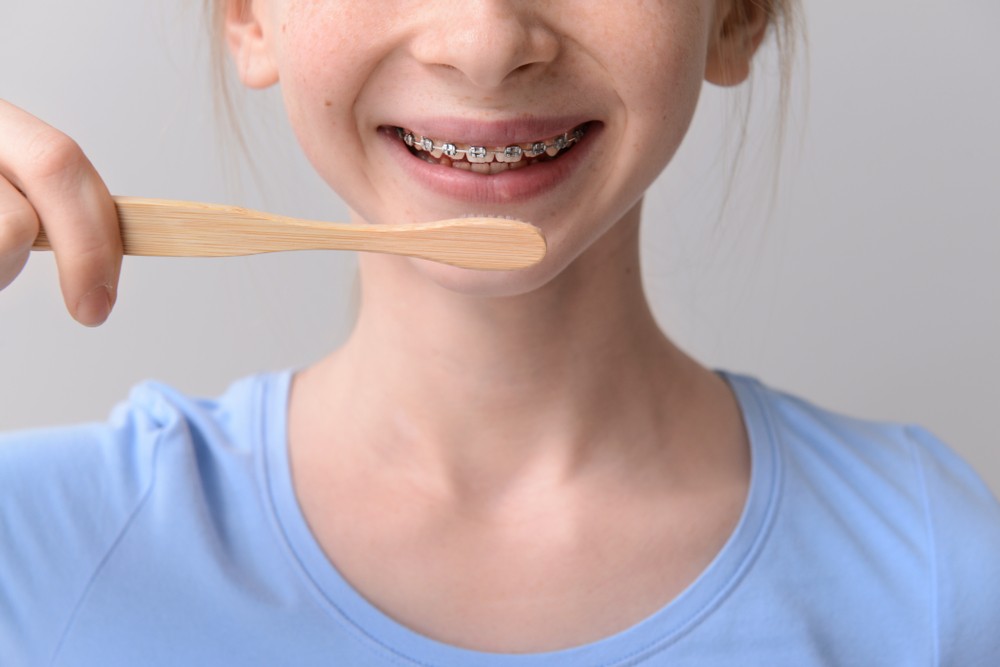 aparat dentar bucuresti, aparat dentar copii, clinica stomatologica orto care bucuresti