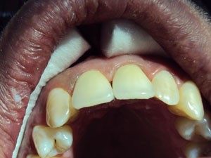 Caz 3 - Protetică dentară