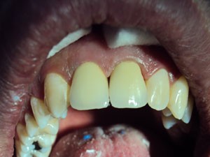 Caz 3 - Protetică dentară