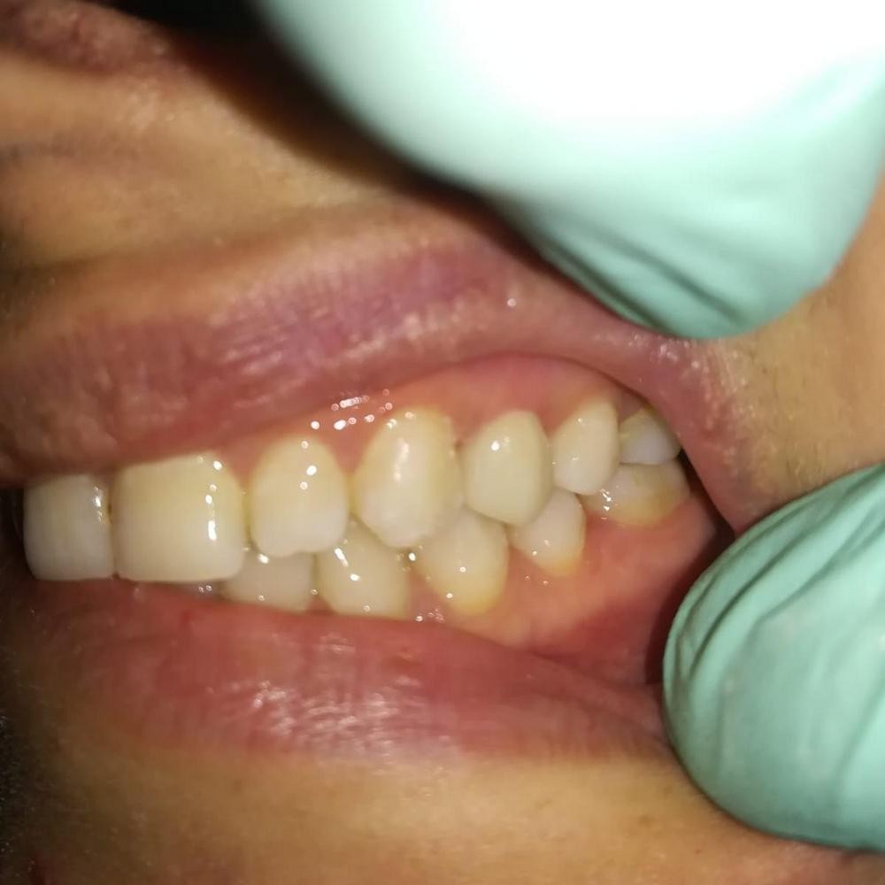 Caz 9 - Protetică dentară