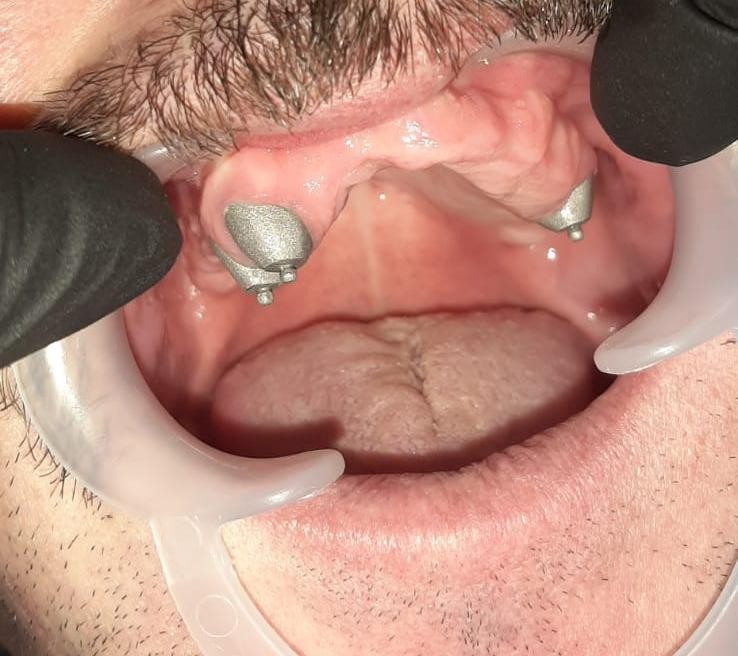 Caz 10 - Protetică dentară