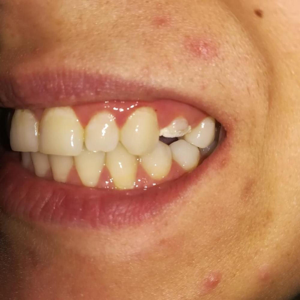 Caz 9 - Protetică dentară
