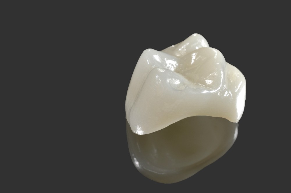 protetica dentara orto care, coroane dentare, coroane dentare bucresti, protetica dentara bucuresti