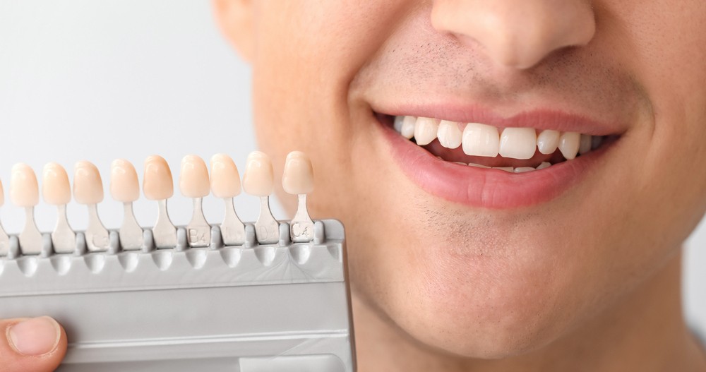 estetica dentara orto care, fatete dentare bucuresti, albire dentara bucuresti